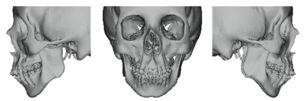 3D CT Reconstruction- Slide 1