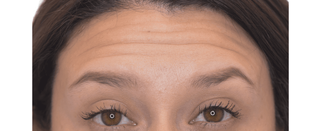 June 2025 Blogs | Dallas Surgical Arts