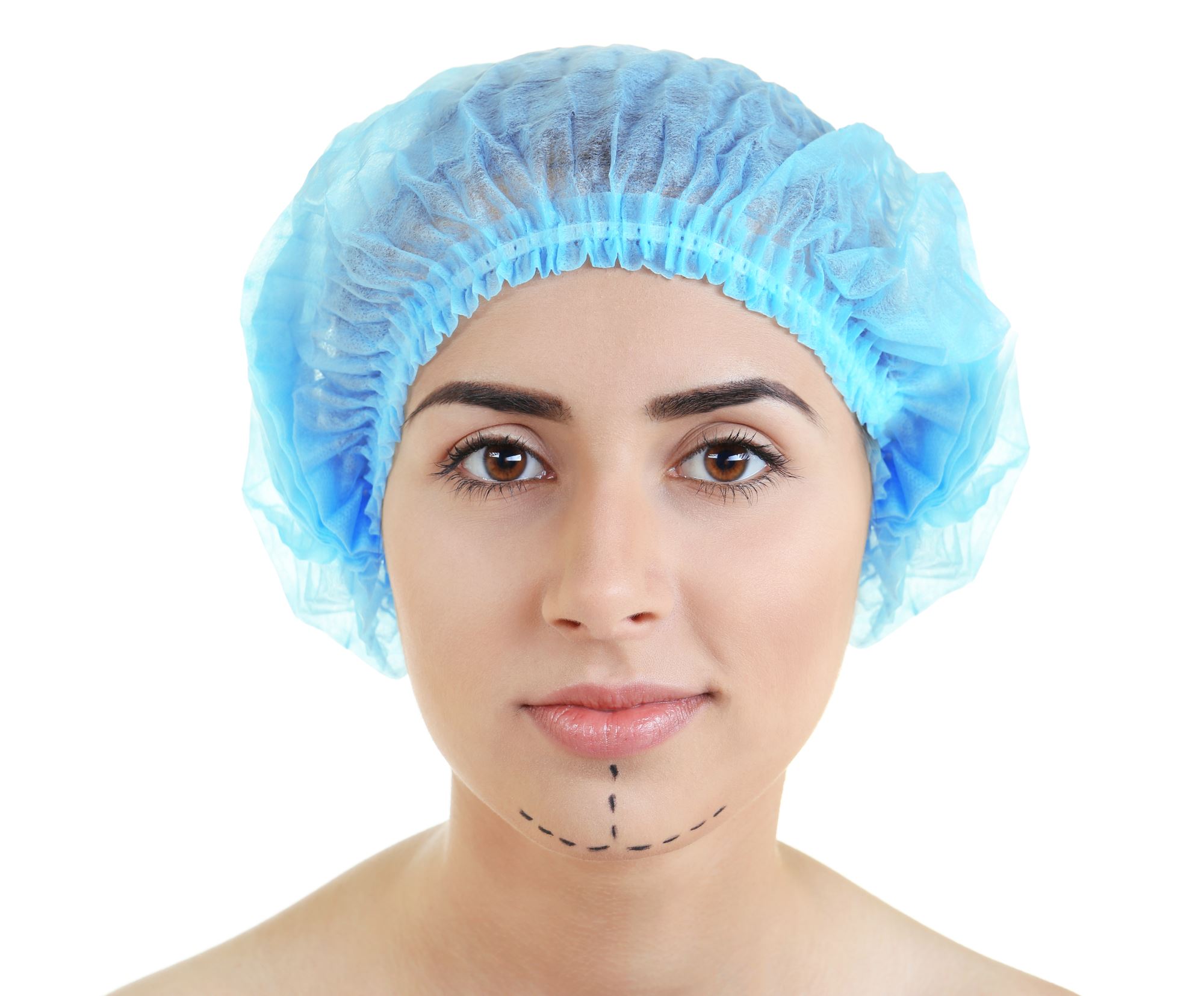 young woman with blue surgical cap and plastic surgery marking chin implants