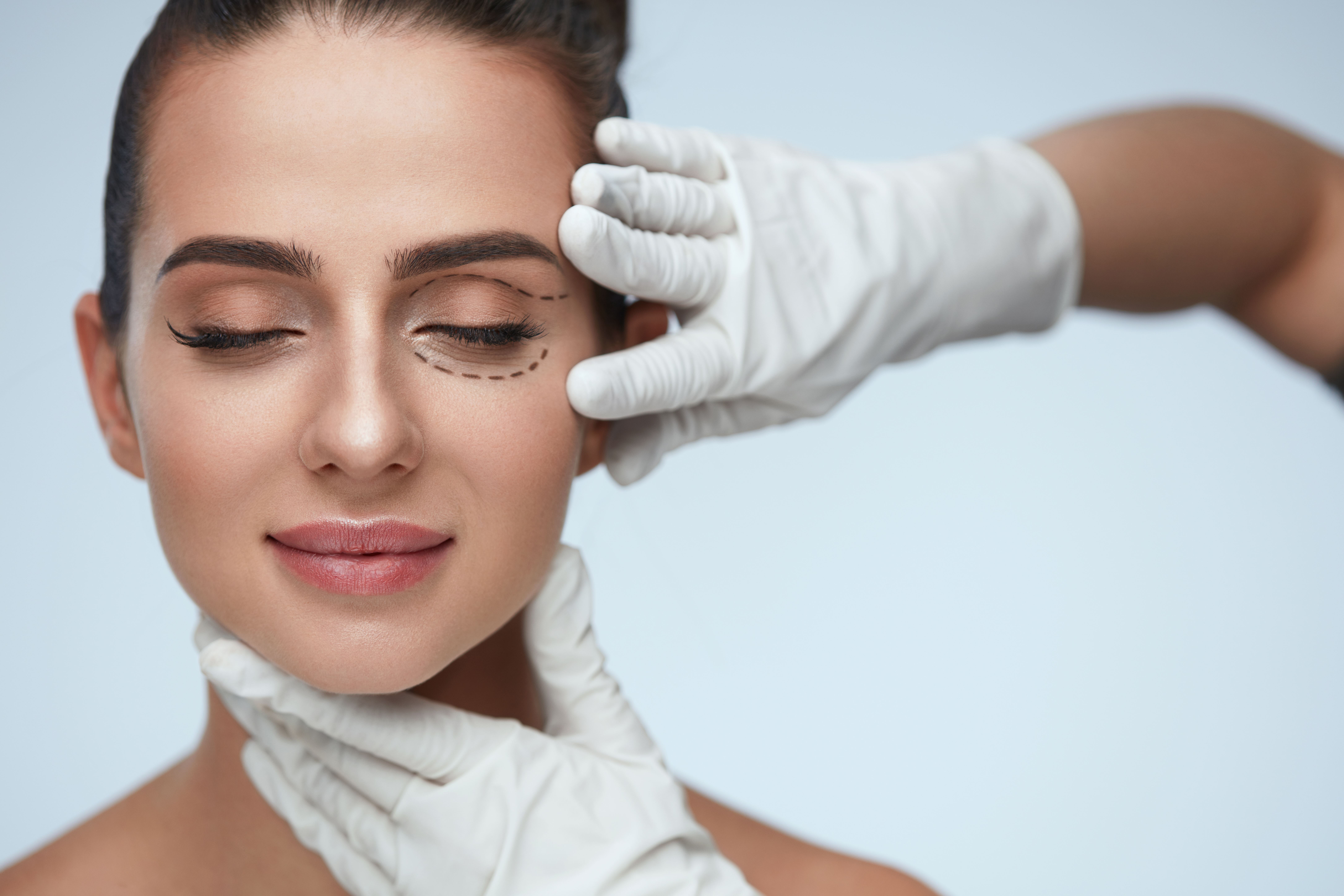 hands wearing surgical gloves on woman's face outlining eyelid surgery