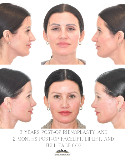 Face Surgery Types: Popular Cosmetic Procedures this Winter 2026