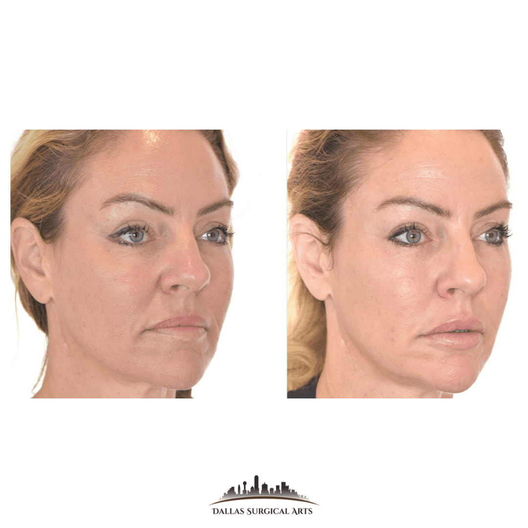 Preventative Treatments in 2025: What Younger Patients Need to Know