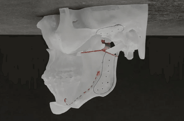 Jaw Diagram- Slide 2