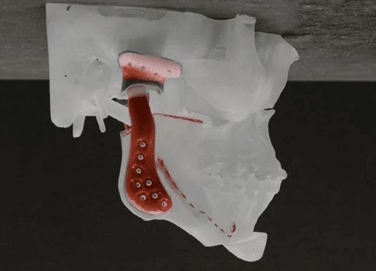 Jaw Diagram- Slide 3