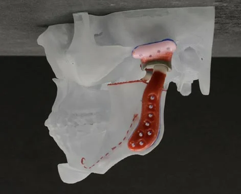 Jaw Diagram- Slide 4